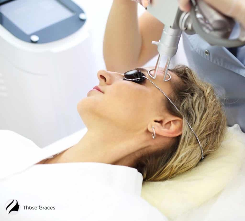 lady getting laser resurfacing treatment