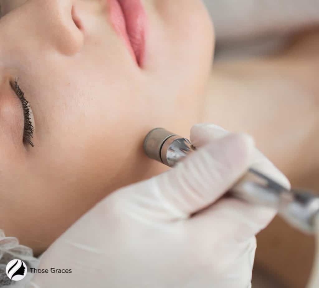 lady using a used microdermabrasion machine