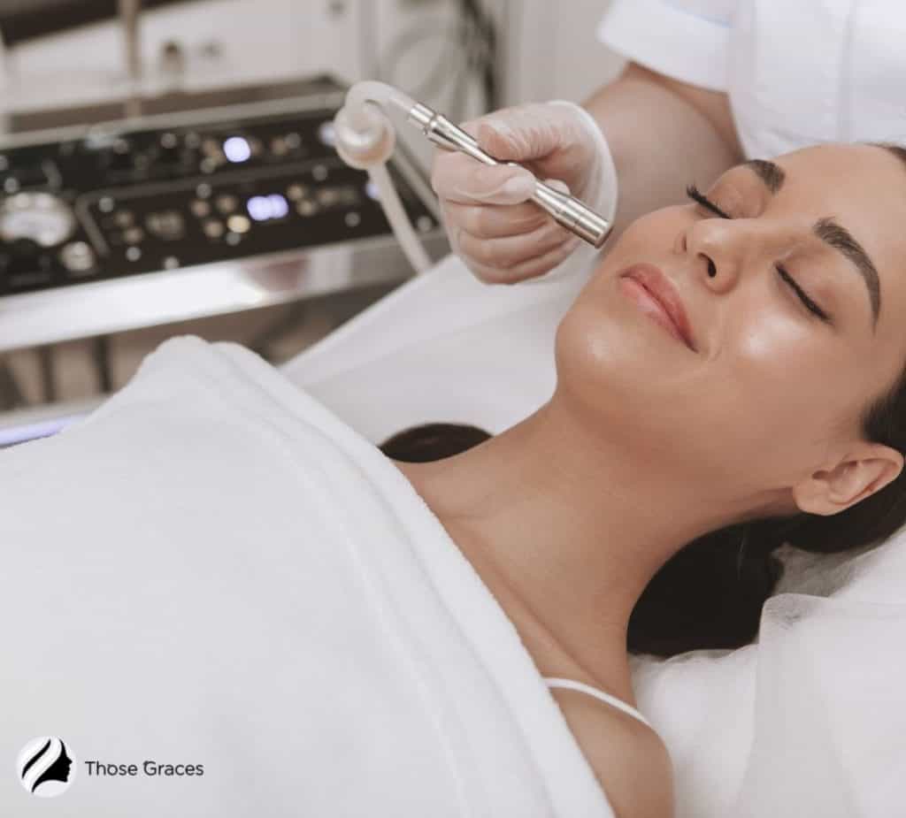 A lady with a glowing skin receiving microdermabrasion treatment