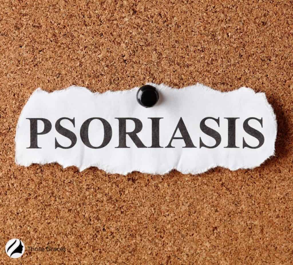 PSORIASIS pinned on the board