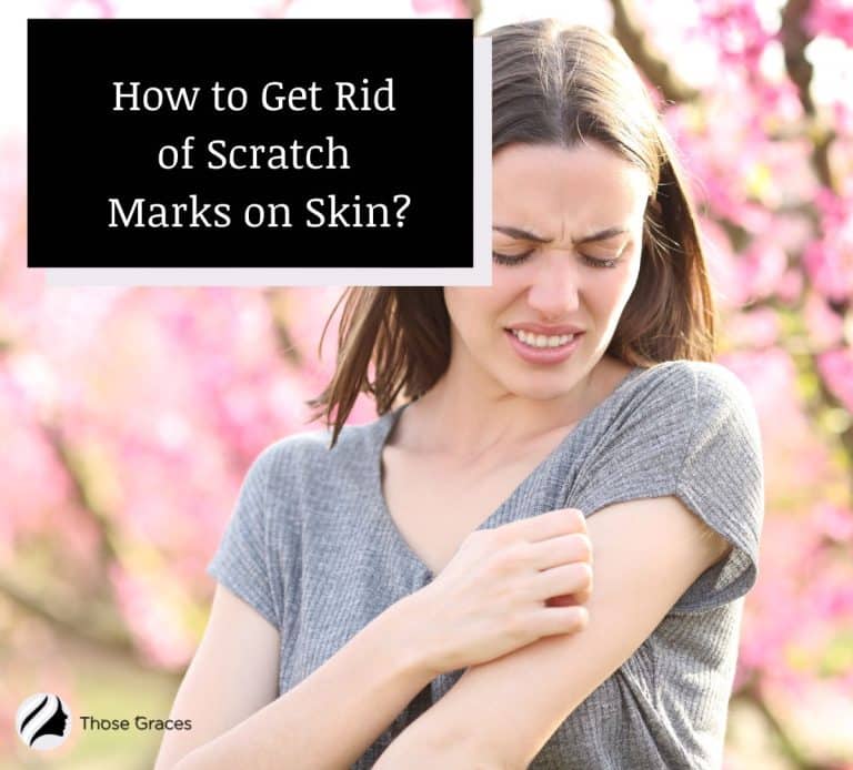 how-to-get-rid-of-scratch-marks-on-skin-9-effective-methods