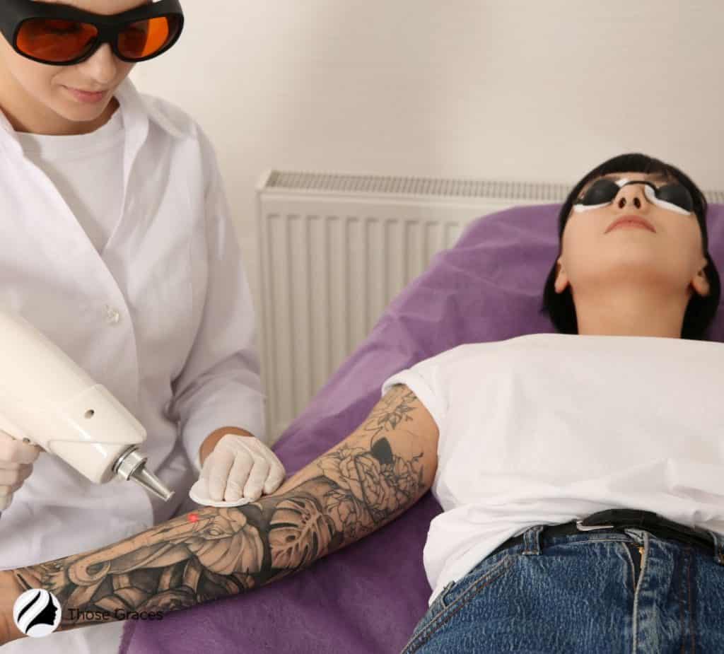 women removing tattoo but how long does tattoo removal take