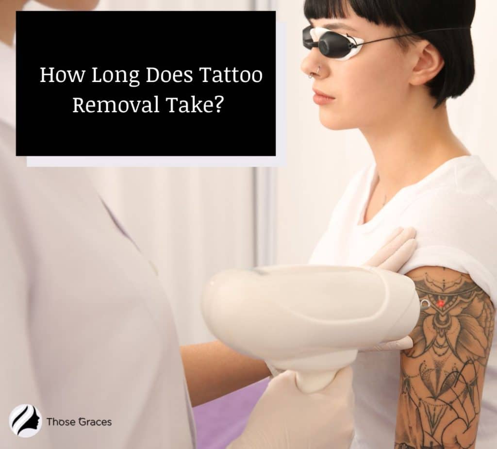 How Long Tattoo Removal Take