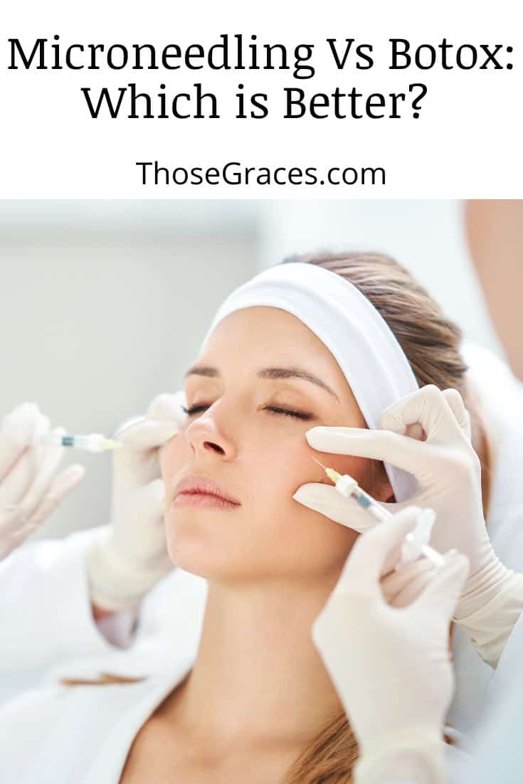 Microneedling Vs Botox: What’s the Best Choice? [Comparison ...