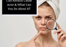 Can Keratin Cause Acne? Unmask The Truth in This Guide!