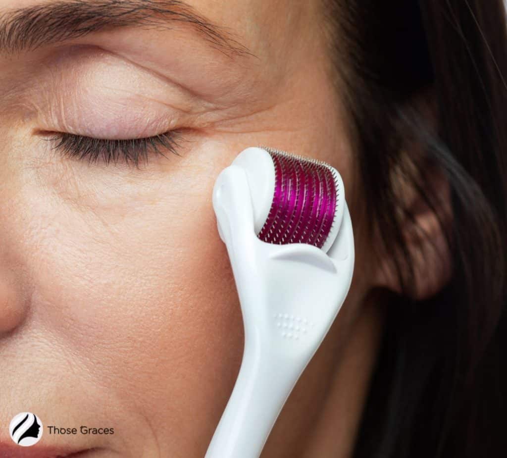 lady using a derma roller on her face