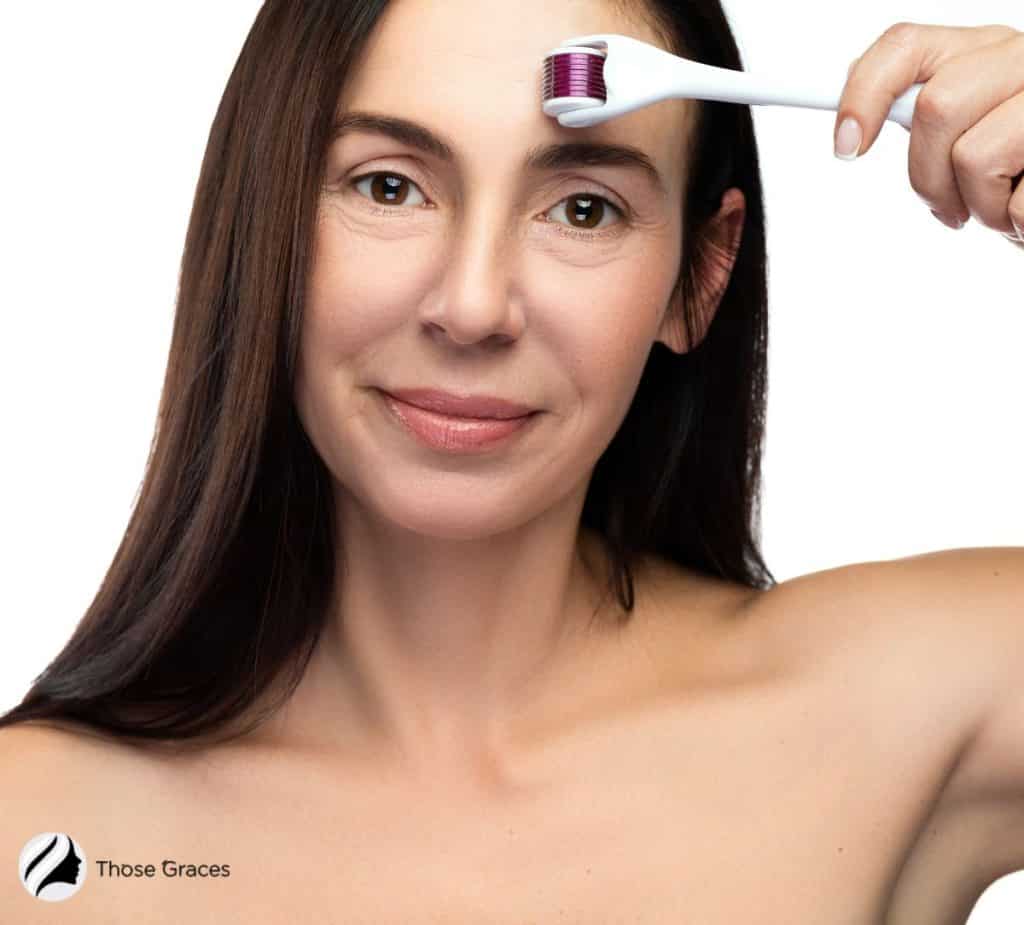 lady using a derma roller