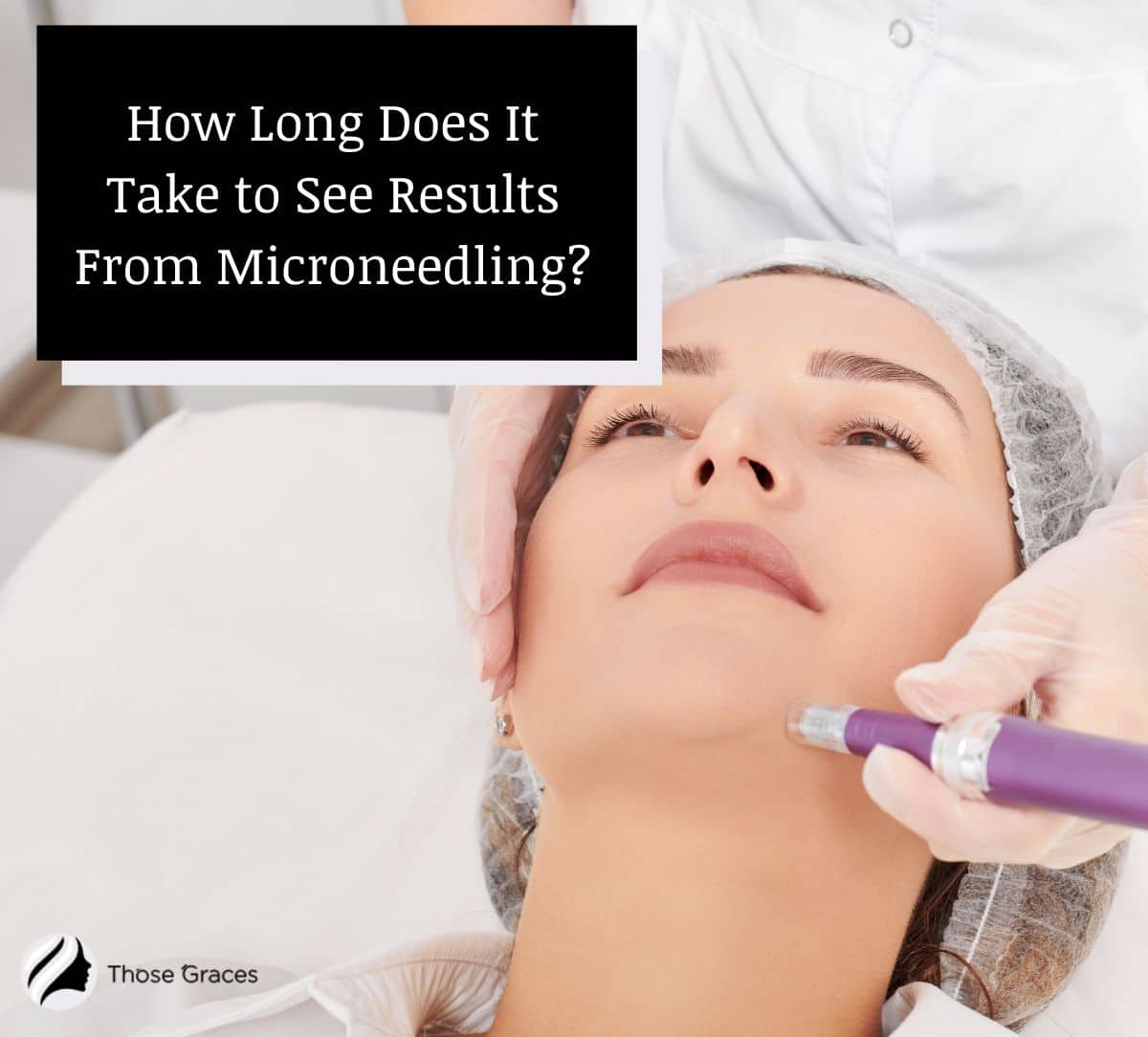 lady getting a microneedling treatment but but How Long Does It Take to See Results From Micro Needling